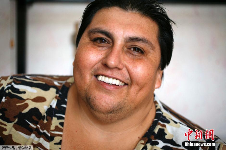 Fallece el mexicano considerado más gordo del mundo
