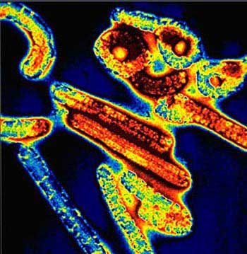 Virus de ébola deja cinco muertos en Sierra Leona