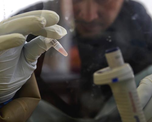 Muere primer paciente de ébola en Arabia Saudí