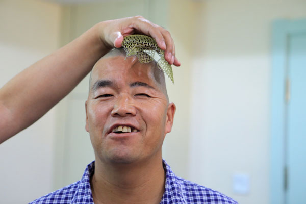 Un médico del Hospital Xijing muestra un soporte craneal de titanio, creado con tecnología de impresión 3D.  El soporte será colocado en la cabeza de un paciente para reparar la parte dañada de su cráneo. El paciente se cayó de un tercer piso mientras estaba construyendo una casa.