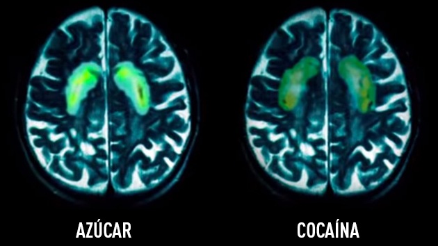 El azúcar produce el mismo efecto que la cocaína en el cerebro 