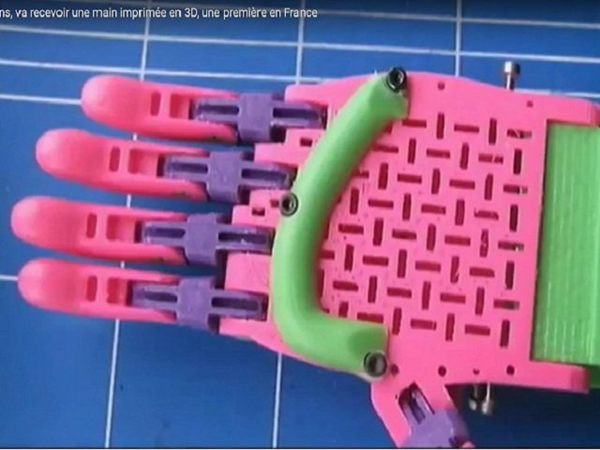 Niño sin mano recibe prótesis hecha con impresora 3D