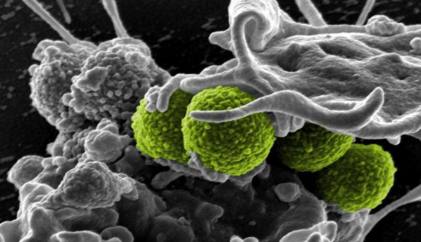 Una superbacteria altamente mortífera se propaga por el mundo