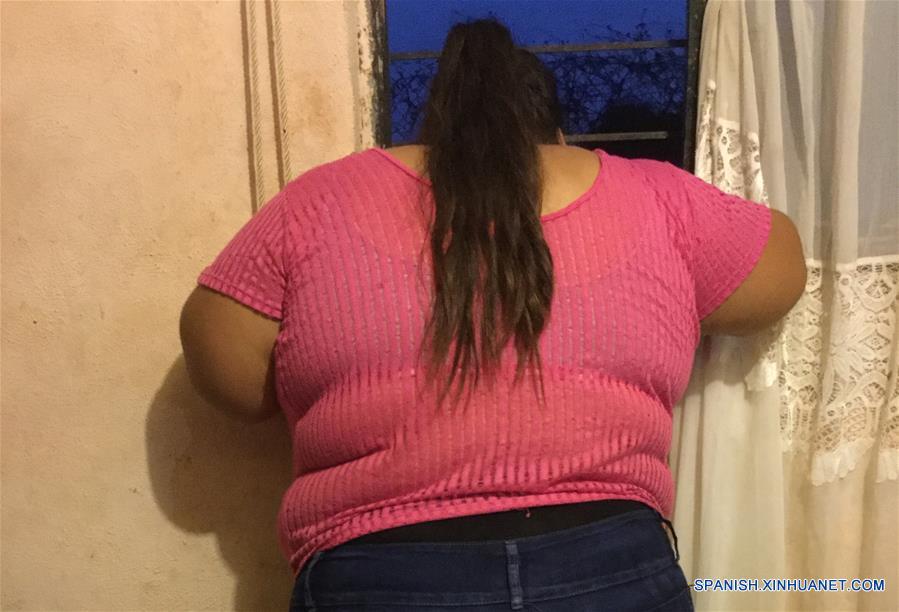 Adolescente mexicana será sometida a "by-pass" gástrico al pesar 200 kilos