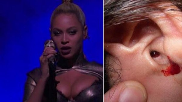 Beyoncé empieza a sangrar en un concierto