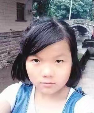 La sociedad china apoya a joven china que sufrió graves quemaduras por intentar ayudar a su padre discapacitado