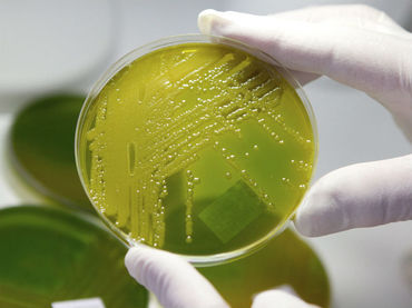 Identifican bacteria resistente a cualquier tipo de antibiótico