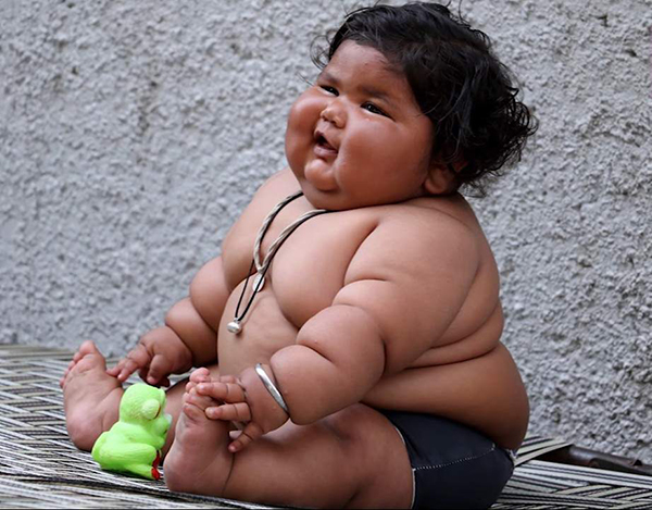 Un bebé de ocho meses pesa 17 kilos y come como una niña de 10 años