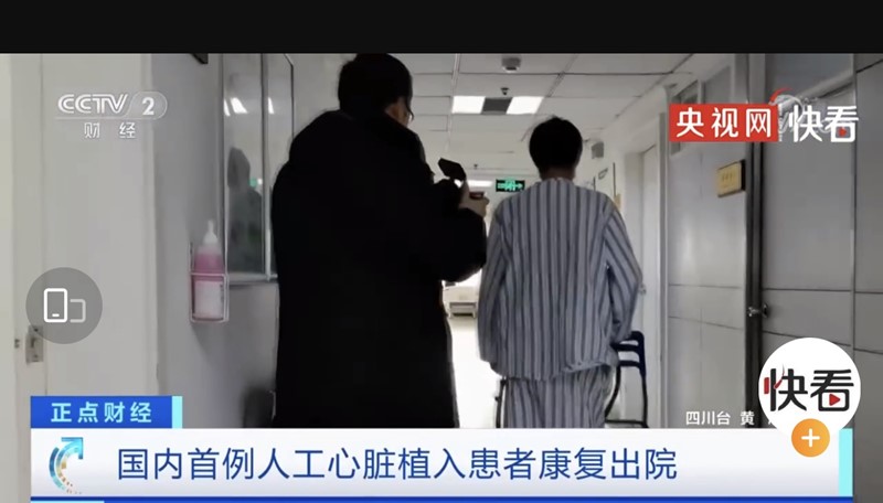 Un paciente de Sichuan recibe el primer corazón artificial “hecho en China”