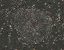 Los científicos estadounidenses encuentran células madre embriónicas en la piel