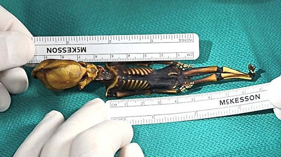 El 'mini extraterrestre' encontrado hace diez años en Chile contiene ADN humano