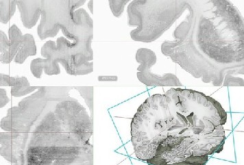 Científicos crean primer cerebro digital 3D
