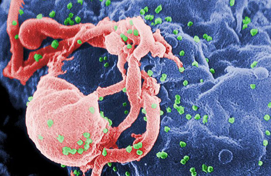Utilizan con éxito el VIH para curar dos enfermedades genéticas