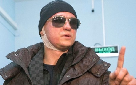 Vuelve a Moscú el director del Bolshói atacado con ácido