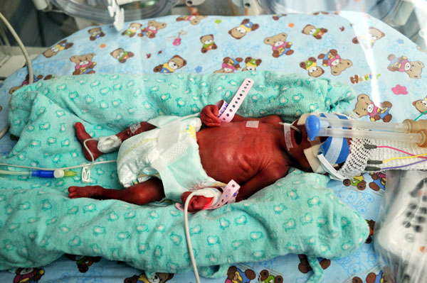 Bebé prematuro en cuidados intensivos