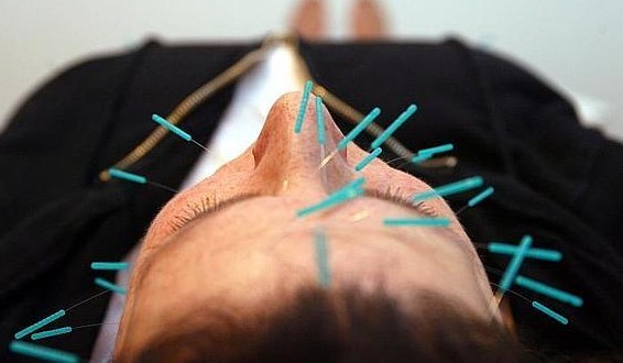 La acupuntura alivia los sofocos de la quimioterapia por cáncer de mama