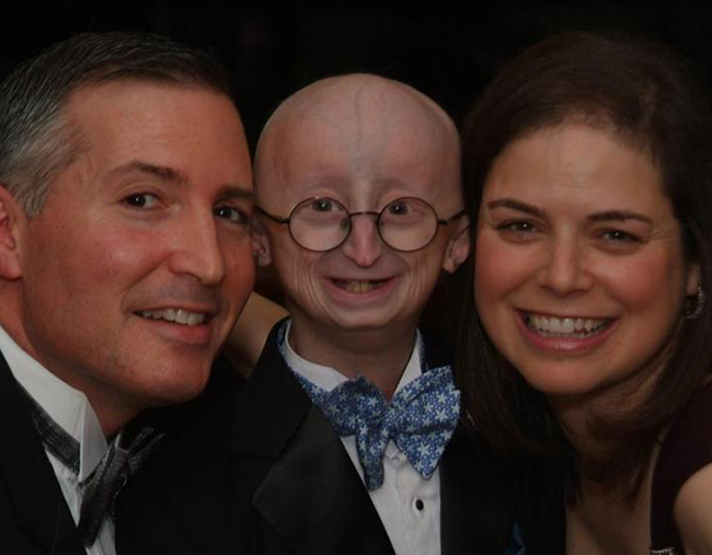 Falleció Sam Berns, el joven símbolo del envejecimiento prematuro