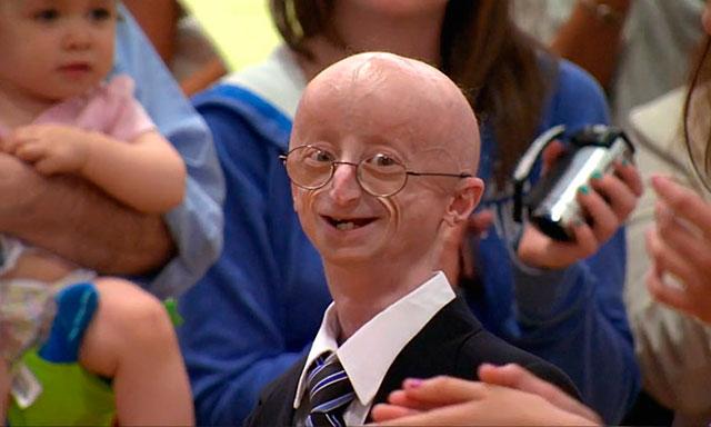 Falleció Sam Berns, el joven símbolo del envejecimiento prematuro