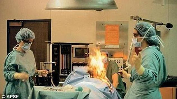 Médicos noruegos prenden fuego a un paciente durante una operación a corazón abierto