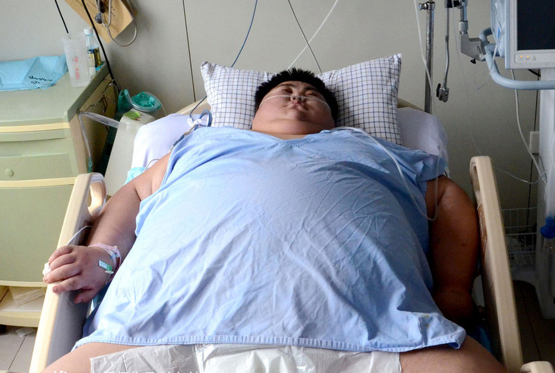 La persona más obesa de China muere tras parada cardiaca