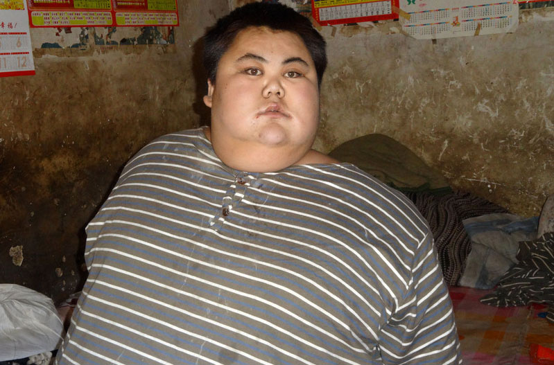 La persona más obesa de China muere tras parada cardiaca