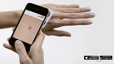 Crean aplicación móvil para diagnosticar cáncer de piel